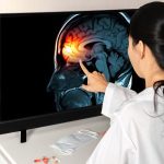 BRAIN INJURY CLAIMS