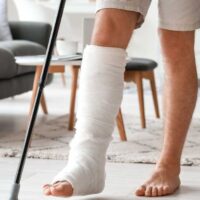 Florida broken bones attorneys